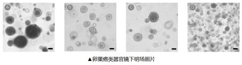 百奥创新：卵巢癌3d类器官培养基介绍 知乎