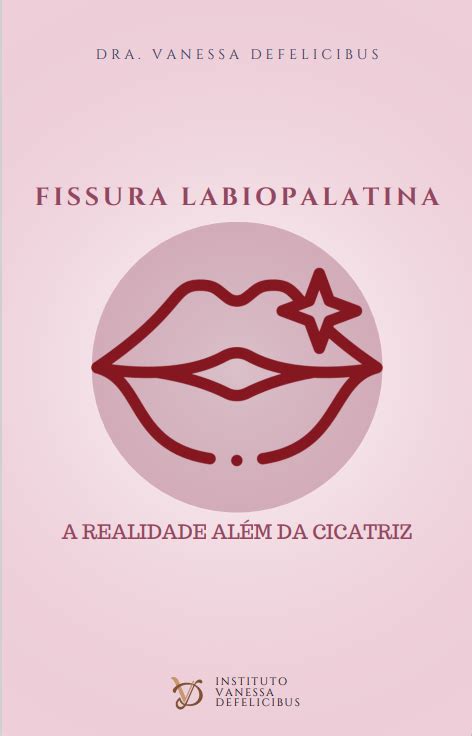 Ebook Projeto Para Pacientes Fissura Labiopalatina Dra Vanessa