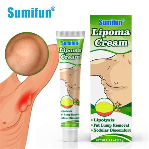 20g Lipoma Removal Cream Treat Tumor Skin Swelling Ointment 100