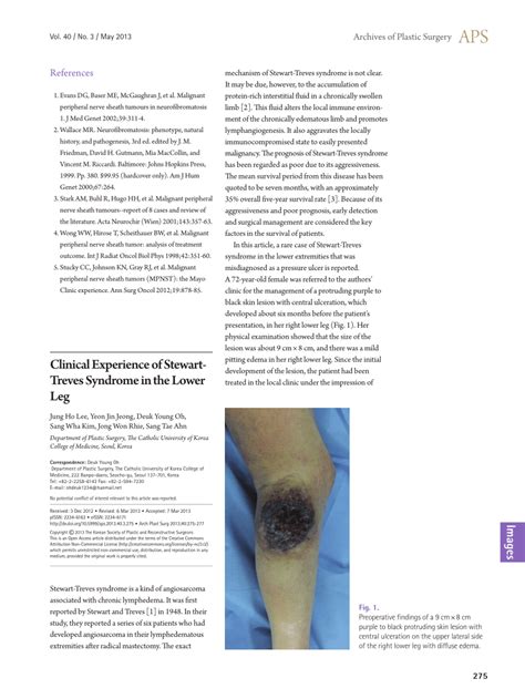 PDF Clinical Experience Of Stewart Treves Syndrome In The Lower Leg