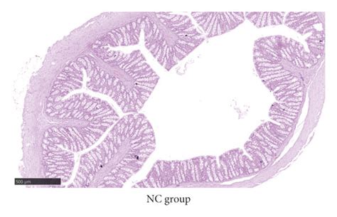 Histopathological Sections From Rat Colons In Each Group And