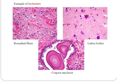 NMS GI Path Exam 1 Flashcards Quizlet