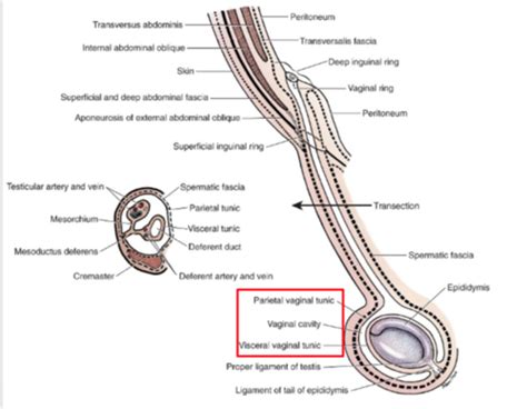 Lecture Testicular And Prostatic Surgery Flashcards Quizlet