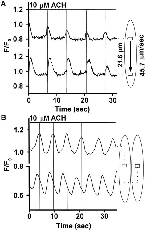 A Ca2 Oscillations As Intracellular Ca2 Waves Using Confocal