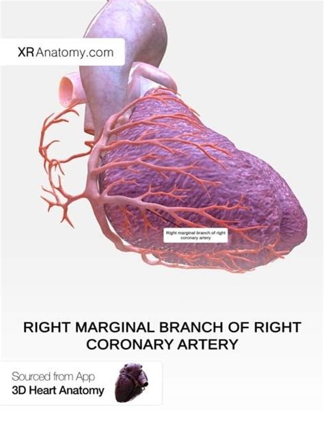 Right Coronary Artery Xr Anatomy