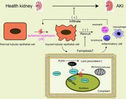 缺血/再灌注后细胞质 HMGB1 诱导肾小管铁死亡,International Immunopharmacology - X-MOL
