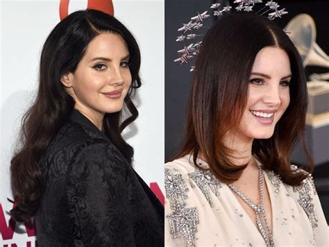 Lana Del Rey Plastic Surgery Before And After Pictures