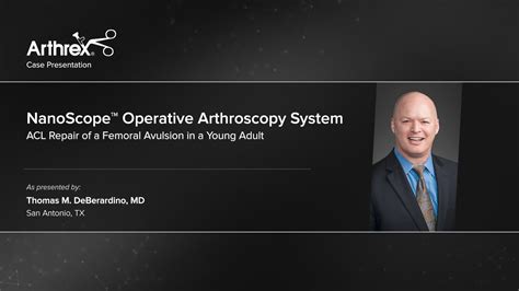 Arthrex Nanoscope Operative Arthroscopy System Acl Repair Of A