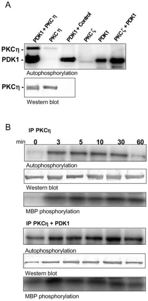 Pdk Activates Pkc A Pdk Phosphorylates Pkc Immunoprecipitates Of