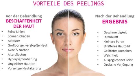 Fruchtsäurepeeling Chemisches Peeling Frauenarztpraxis Dr med