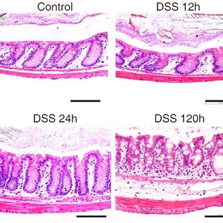 Histology Of Mouse Colon Stained With Haematoxylin Eosin For Different