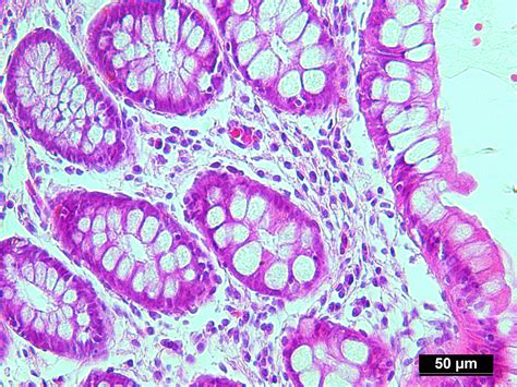 Human Colon Tissue (Normal) FFPE Sections