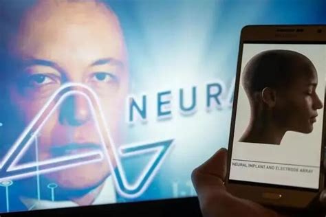 Elon Musk Dice Que Neuralink Implant Por Primera Vez Un Chip Cerebral