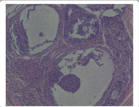 Antral Follicles From Nude Mice 2 5 Months After Human Tissue