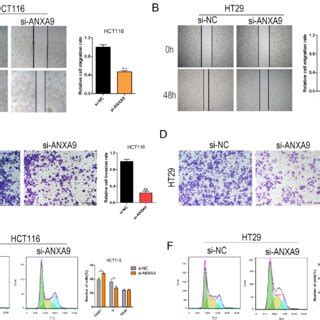 ANXA9 Knockdown Suppresses The Cell Migration Invasion And Cell Cycle