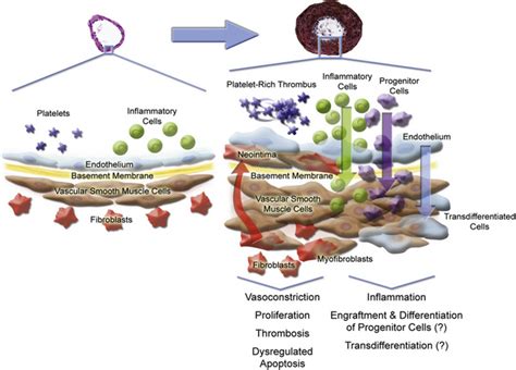 Pulmonary Arterial Hypertension Clinical Gate