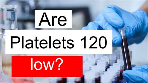 Is Platelet count 120 low, normal or dangerous? What does Platelet ...