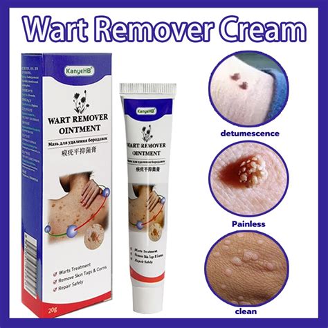 Warts Remover Original Warts Remover Warts Remover Cream Genital Warts Remover Plantar Warts