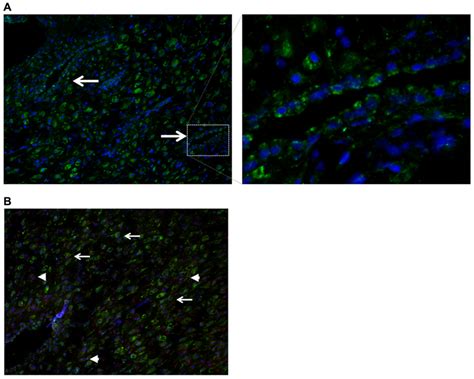 Frontiers Maternal Nodal Inversely Affects Nodal And Stox1 Expression