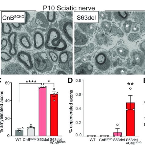 Ablation Of CnB In S63del Schwann Cells In P10 Sciatic Nerves A EM Of