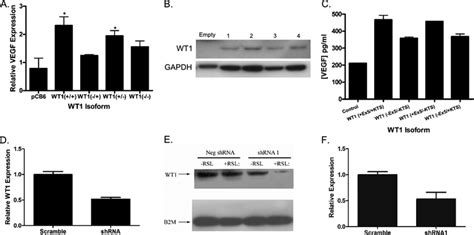 Modulating Wt1 Expression In Ewing Sarcoma Cell Lines Affects Vegf