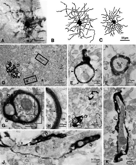 Light And Electron Microscopy Of Biocytin Filled Complex Cells With