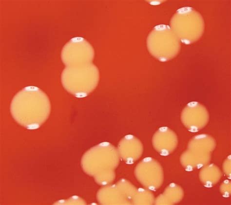 Micrococcus luteus | bacteria | Britannica.com