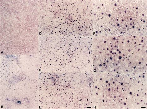 Immunohistochemical Staining For 4 Hne Pa Control Livers And Livers Download Scientific