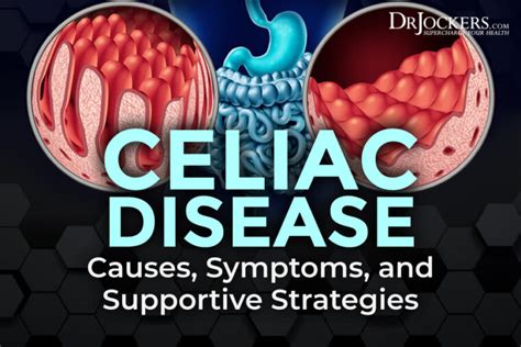 Celiac Disease Symptoms And Treatment Faqs