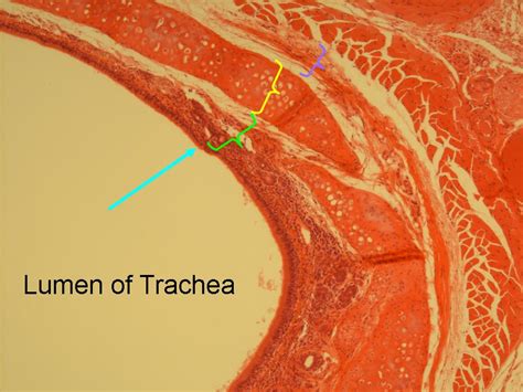 Trachea Histology Slides Labeled