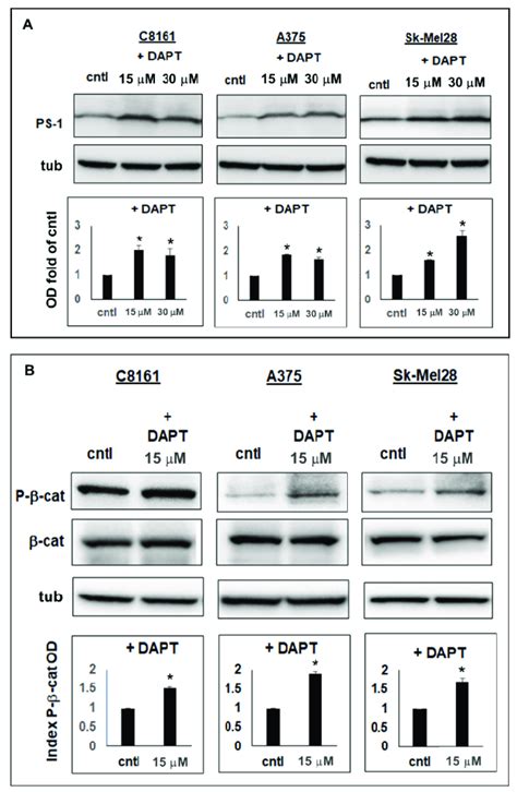 Effects of GSI treatment on PS 1 and P β catenin levels in aggressive