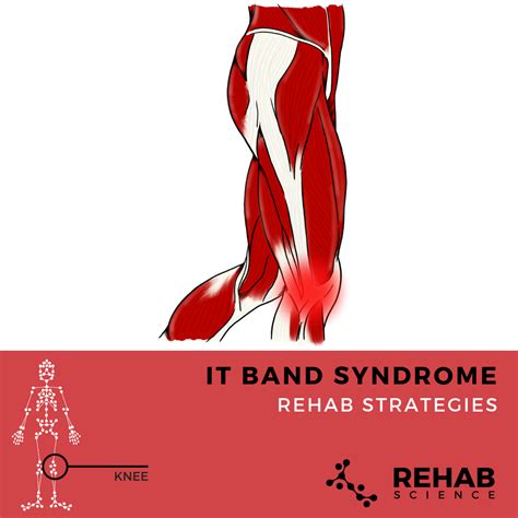 IT Band Syndrome - Rehab Science