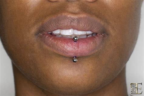 Vertical Labret Piercing Swelling Collectisale Instrumentation Kmitl