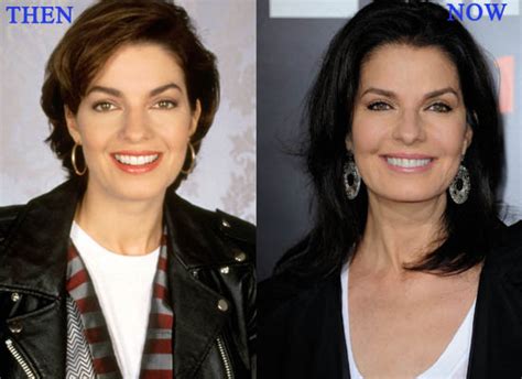 Sela Ward Plastic Surgery Before And After Botox Injections And Facelift