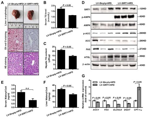 SIRT1 Overexpression Suppresses Hepatic Triglyceride Accumulation In