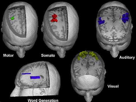 Human Brain Mapping. FMRI mapping of different functional systems in a ...