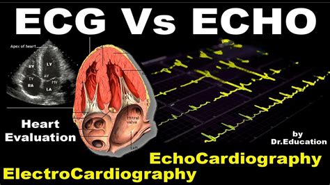 Rx Heart Epi 16 E ECG Vs ECHO ENG Electrocardiography Vs