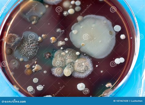 Petri Dish With Colonies Of Bacteria Stock Photo Image Of Disease