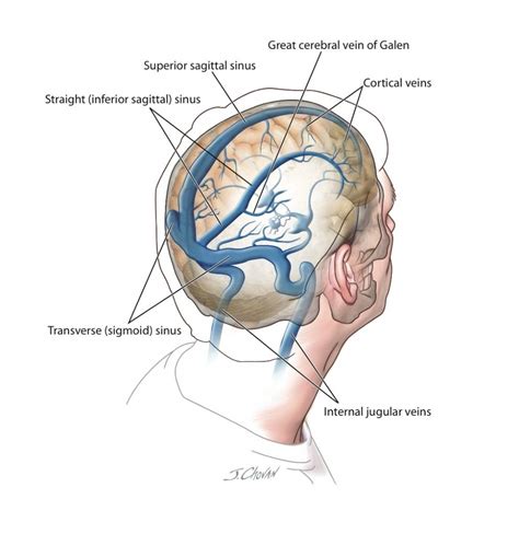 Anatomy Of Sinuses In Head Anatomical Charts And Posters