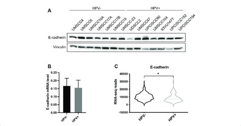 Analysis Of E Cadherin Expression In Hpv Positive And Hpv Negative Hnc