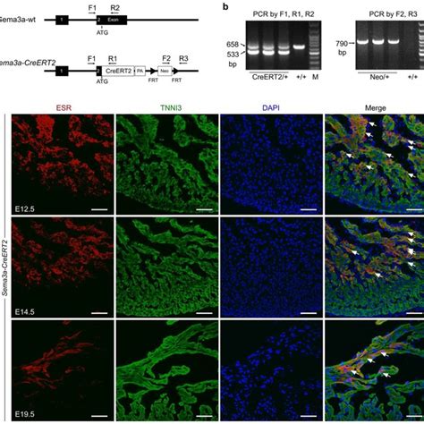 Generation And Characterization Of The Sema3a Creert2 Knock In Mouse