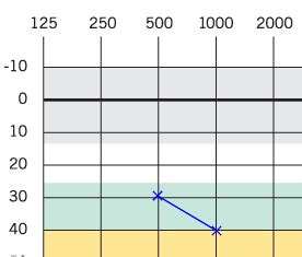 Understanding an audiogram (hearing test results)