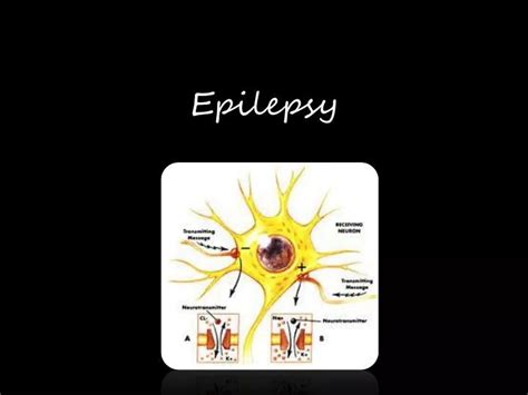 Ppt Epilepsy Powerpoint Presentation Free Download Id2668418