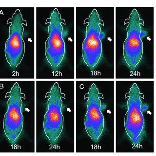 Spect Imaging Of Tumor Bearing Nude Mice Injected With M