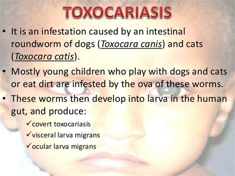 Toxocariasis