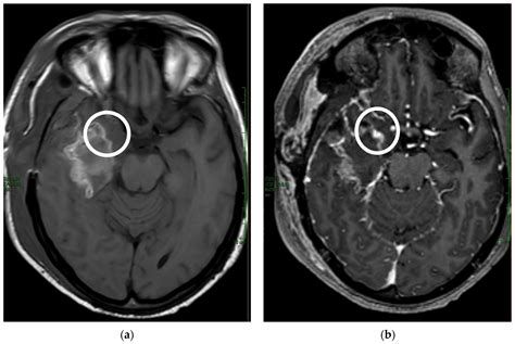 Tomography Free Full Text T Weighted Contrast Enhancement