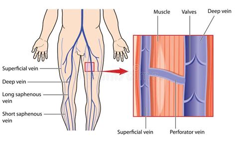 Venas del brazo ilustración del vector Ilustración de médico 52825587