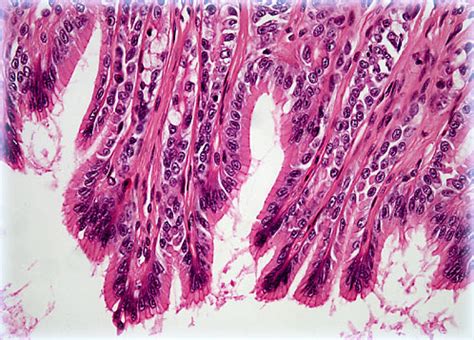 Simple Columnar Epithelium