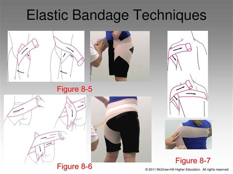 PPT Chapter 8 Bandaging And Taping PowerPoint Presentation Free