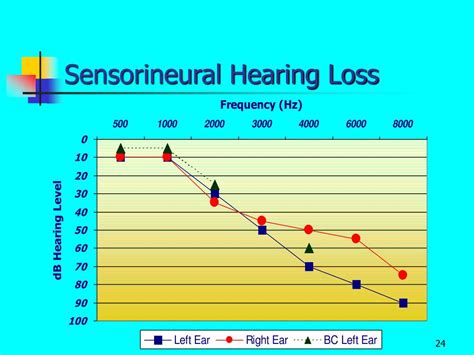 PPT - The Audiogram PowerPoint Presentation - ID:199868